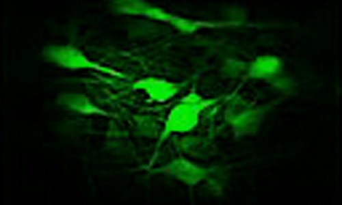 Microscopy showing green channel cells
